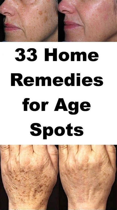 The Best Ways To Do Away With Warts Naturally Wartsonhands