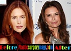 Roma Downey Plastic Surgery Before and After | Plastic Surgery Magazine