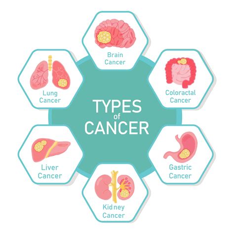Types Of Cancer Diagram Design 1340505 Vector Art At