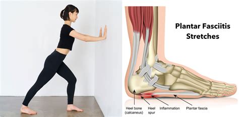 what is plantar fasciitis symptoms causes and stretches explained powerstep