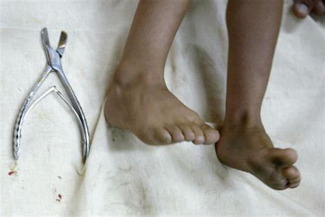 German Court Rules Religious Circumcision Of Minors Is Assault The World From Prx
