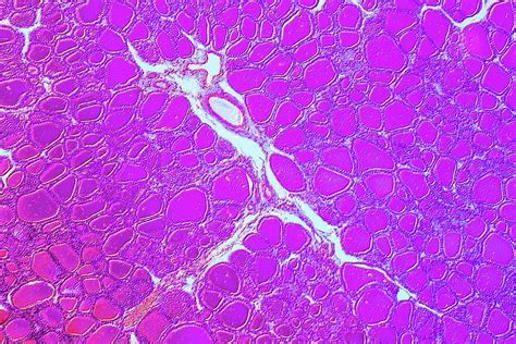 Cuboidal Epithelium Photograph By Alfred Pasiekascience Photo Library