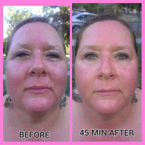 my mothers facial before and after the itworks facial applicator it works global facial it