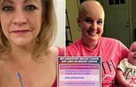 The Breast Cancers That DON T Start With A Lump Two Survivors Of Rarer