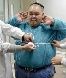 ‘fattest Man In China Weighing 40 Stone Set To Undergo Weight Loss