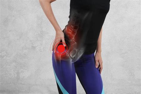 Piriformis Syndrome Is A Real Pain In The Butt Cold Spring Chiropractic