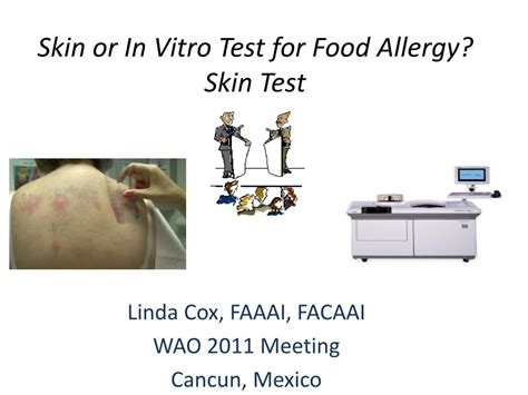 Ppt Skin Or In Vitro Test For Food Allergy Skin Test Powerpoint