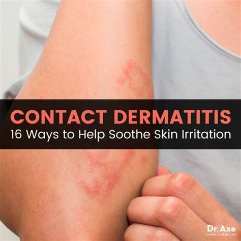 Contact Dermatitis Causes Natural Treatments Contact Dermatitis
