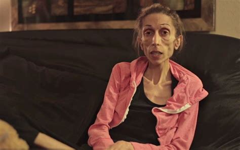 anorexic woman near death makes a heartbreaking plea for help video