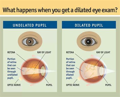 Undilated Vs Dilated Pupil Eye Facts Eye Health Diabetic Eye Disease