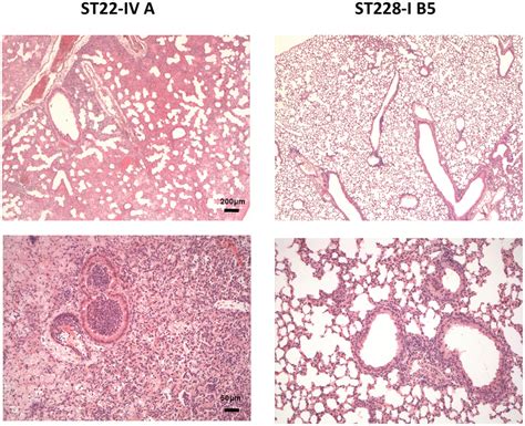 Histopathology In Murine Lung Infected With Mrsa Clones St22 Iv