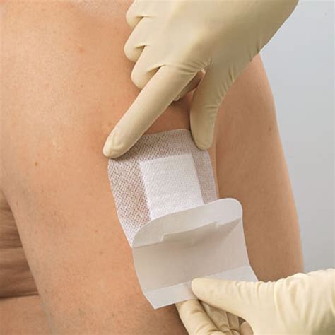 Iodoflex Iodine Paste Pad Dressing Medical Dressings