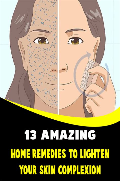 13 Amazing Home Remedies To Lighten Your Skin Complexion Virsbeauty