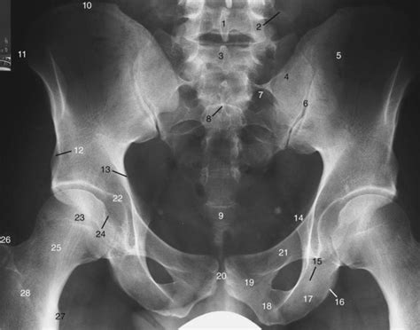 Pelvis X Ray Anatomy Male Pelvis Bones And Joints X Ray Stock