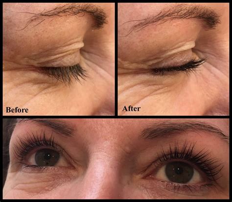 pin on lash lift