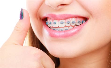 What Is The Best Age To Start Orthodontic Treatment Factors And Considerations Explored By