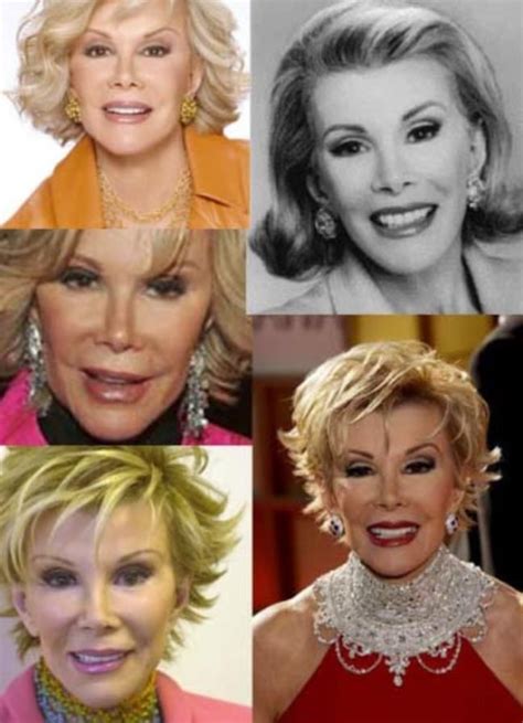Want To Have The Plastic Surgery See The Joan Rivers Plastic Surgery