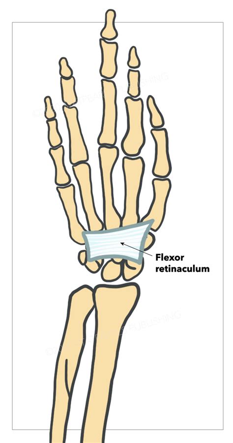 Figure Flexor Retinaculum Wrist Statpearls Publishing Illustration