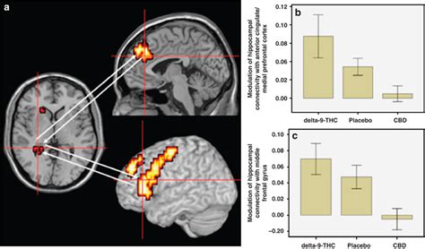 Effects Of Delta 9 Thc And Cbd On Hippocampal Connectivity Brain On