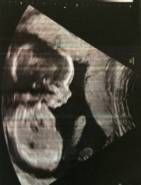 The Baby In This Ultrasound Probably Has A Bigger Wang Than You Ladbible