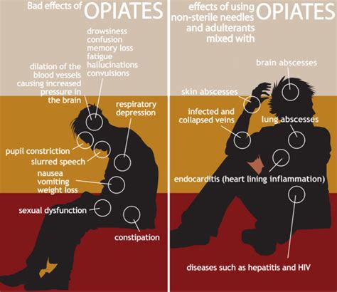 Opioid Addiction Facts Signs Types Of Drugs And More