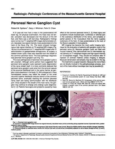 Pdf Peroneal Nerve Ganglion Cyst