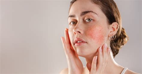 8 Of The Most Common Skin Conditions Sicknwell