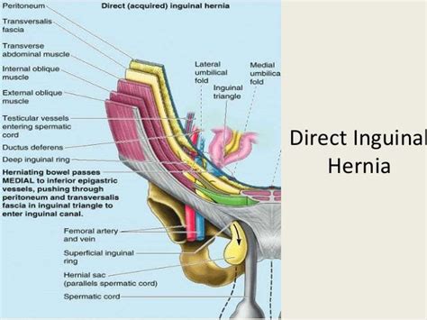 Laparoscopic Inguinal Hernia Repair Tapp