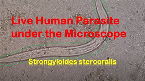 Human Parasites Live Under The Microscope Strongyloides Stercoralis Youtube