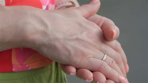 Bulging Veins On Women S Arms Stock Photo Image Of Medical Disease