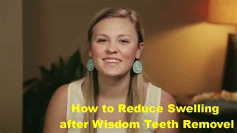 How To Reduce Swelling After Wisdom Teeth Removal Tips For Reduce