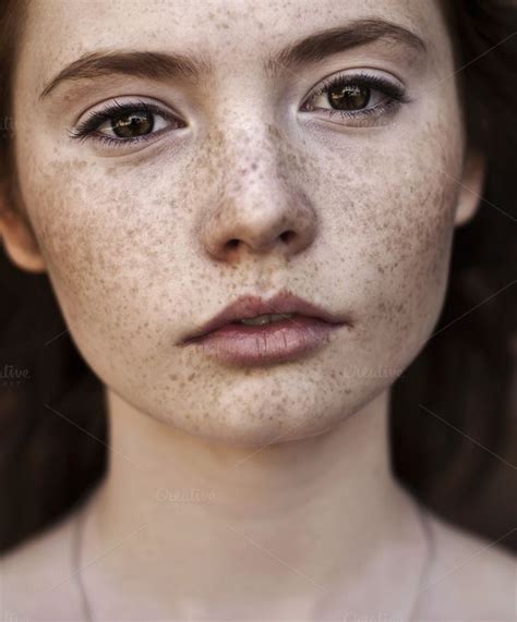 Face Of The Girl With Freckles By Aleshyn Andrei On Creativemarket With Images Dark Spots