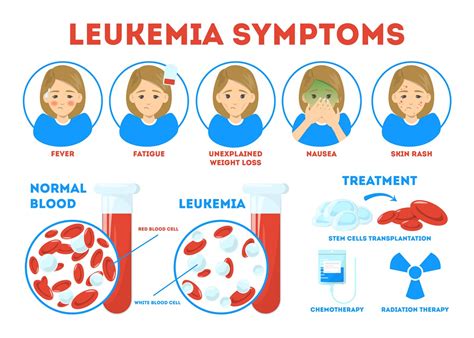 Leukemia Acute Myeloid Adult As Related To Cancer Pictures