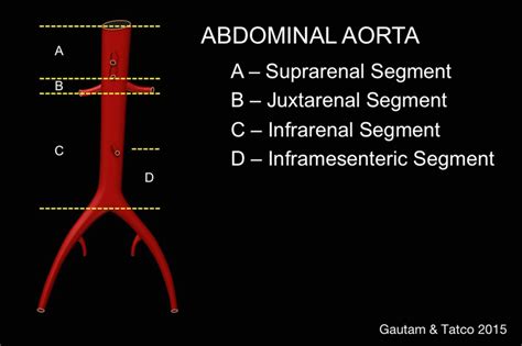 Segments Of The Abdominal Aorta Download Scientific Diagram