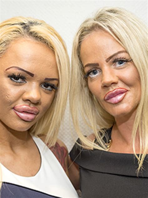 This Mother Daughter Duo Spent 86 000 On Plastic Surgery To Look Like Who Allure