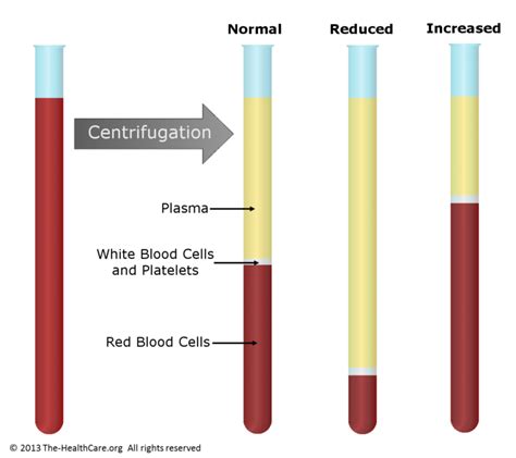 What Test Is Used To Determine The Volume Of Blood Occupied By Red