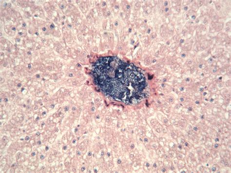 Liver Tissue Of A Cat Lm Stock Image C0093468 Science Photo