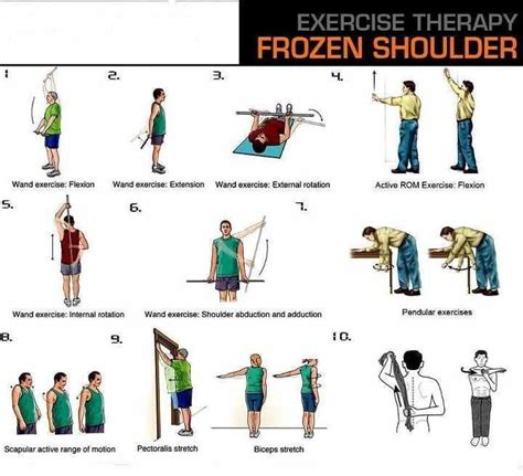 Frozen Shoulder Adhesive Capsulitis Symptoms Causes Treatment