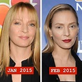Uma Thurman before and after plastic surgery 04 – Celebrity plastic ...
