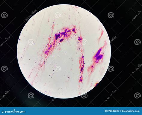 Bacteria Cell In Sputum Sample Gram Stain Method Stock Photo Image Of