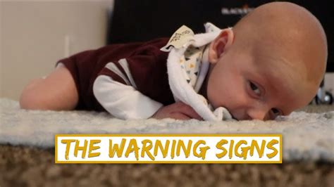 Signs Of Low Muscle Tone In Babies Hypotonia Youtube