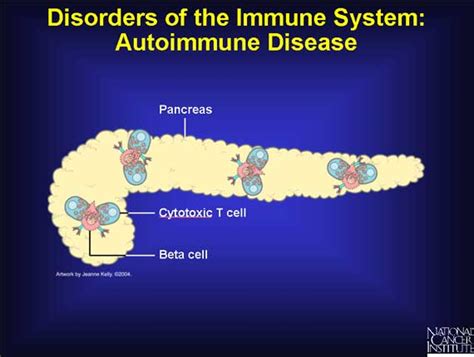 27 Disorders Of The Immune System Autoimmune Disease