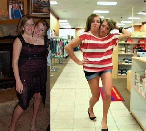 Abigail And Brittany Hensel Conjoined Twins Human Oddities Store