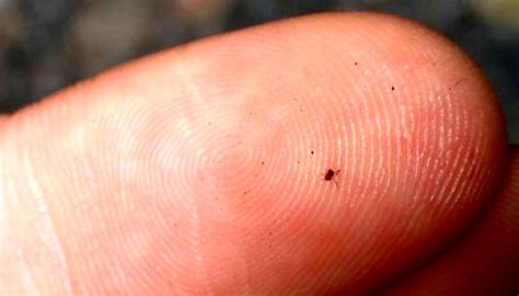 How To Steer Clear Of Chiggers And Enjoy The Outdoors Off The Grid News