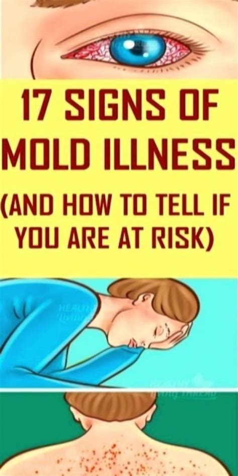 17 Signs Of Mold Illness What It Is And How You Know If You Have It