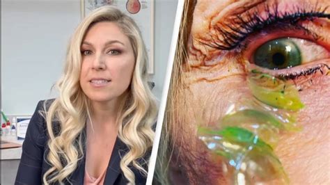 Doctor Who Removed 23 Contact Lenses From Patients Eye Has Never Seen