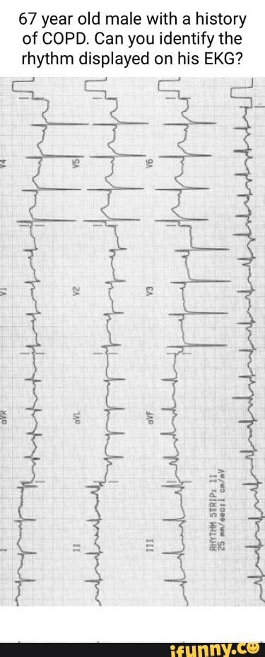 Ekg Memes Best Collection Of Funny Ekg Pictures On Ifunny