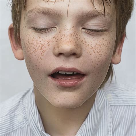 00010 Serov Beautiful Freckles Freckles