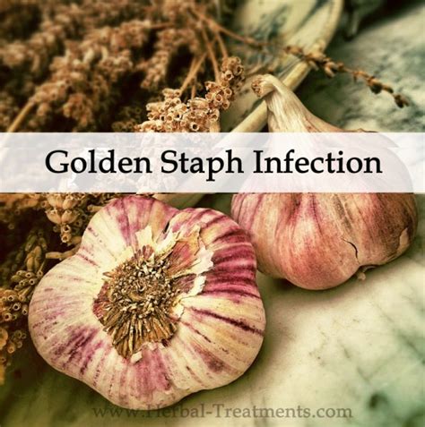 Herbal Medicine Program For Golden Staph Infection Avnayt And Walthams