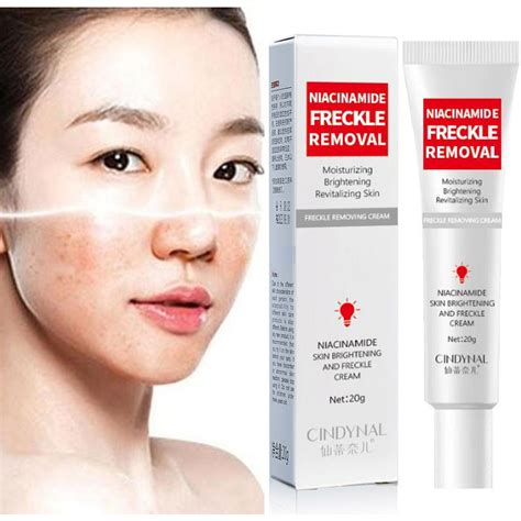 Jual Fuyan Whitening Freckle Cream Remove Dark Spots Anti Freckle Cream Niacinamide Fade